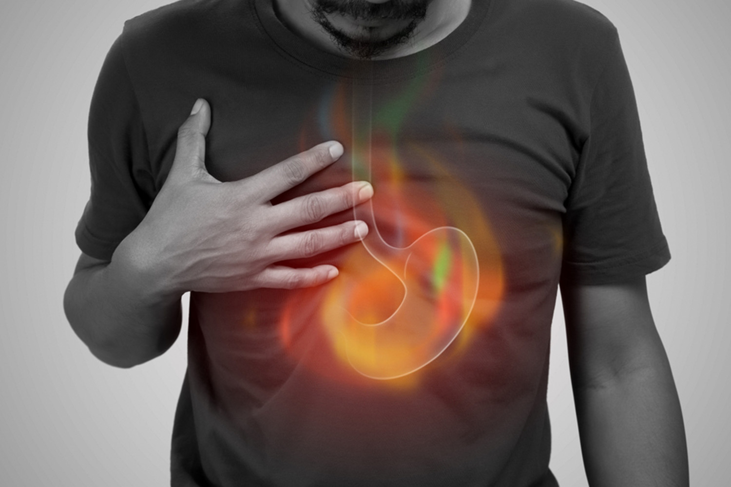 What is Acid Reflux?