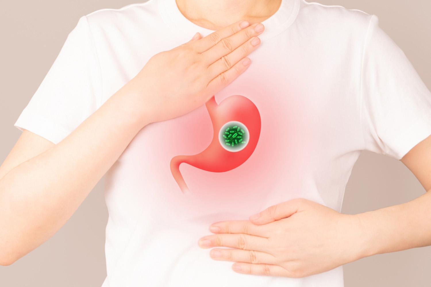 What is H. pylori infection?